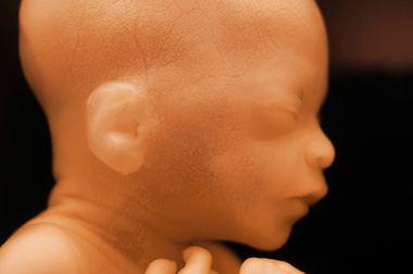 Exodus 21 and Abortion (article)